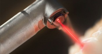 Scientist Discover Tooth Generation Treatment with a Self-Regenerating Laser